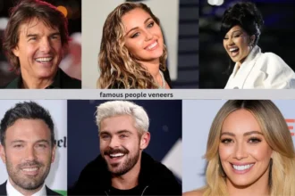 famous people veneers